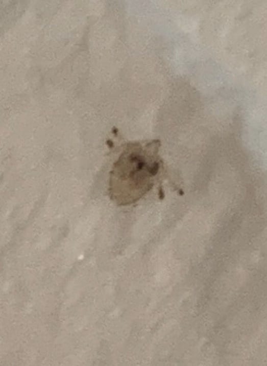 Lice in Eyes & Eyelashes InHome Head Lice Removal